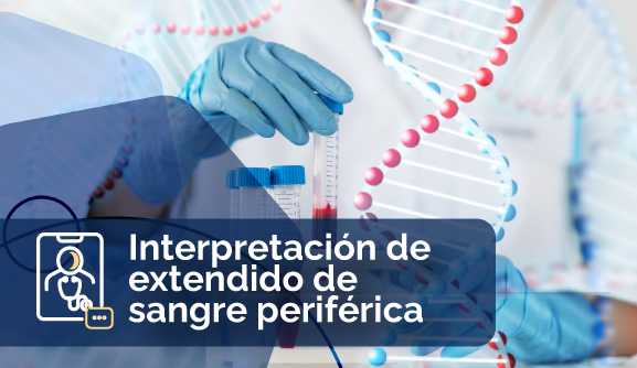 Interpretación de extendido de sangre periférica FUCS